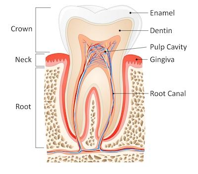 An illustration of a root canal system in Van Nuys. CA