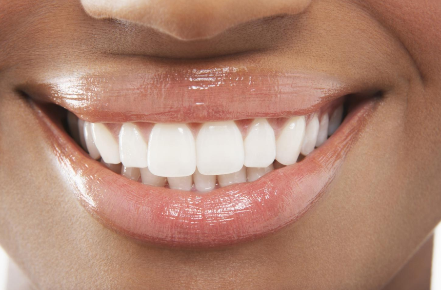 Woman after a smile makeover at the Van Nuys dentist office