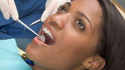 Can I Request to Be Put to Sleep for Wisdom Teeth Removal? | Oral