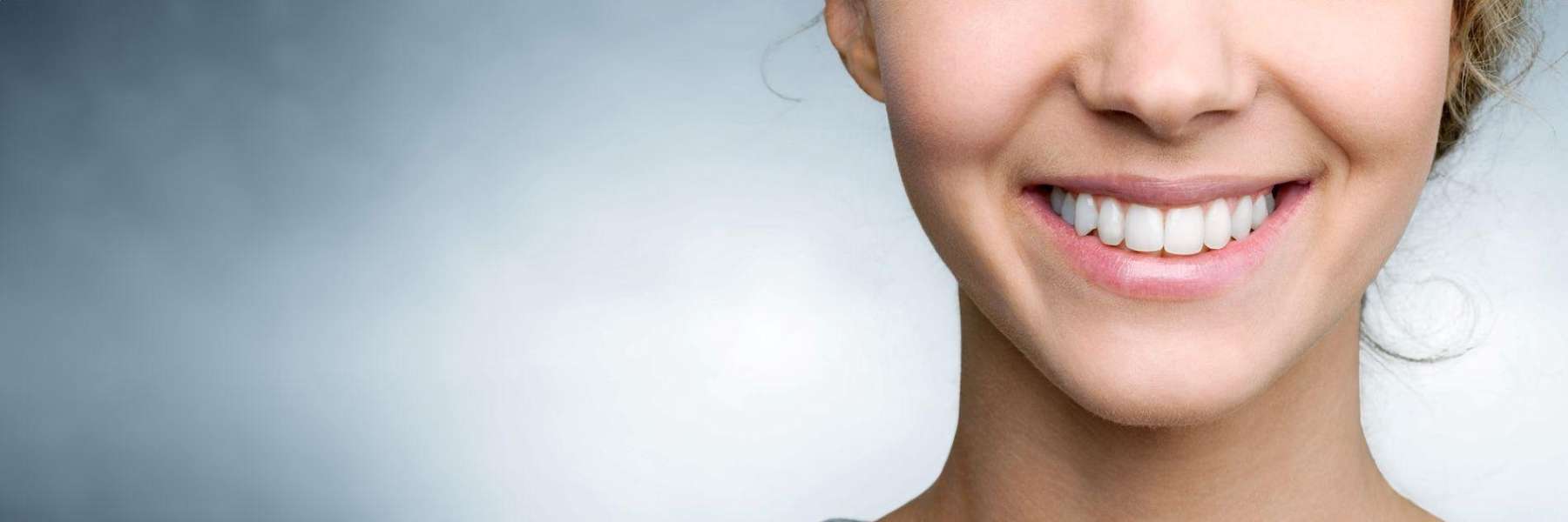 A woman smile showing after result of getting teeth whitening service in Van Nuys