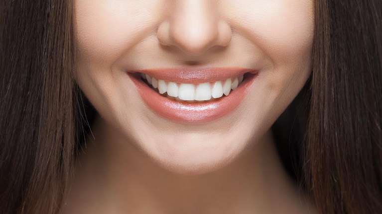 A woman after visting a top Cosmetic Dentist in Van Nuys, CA